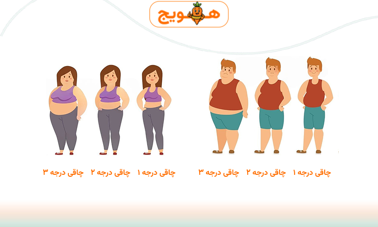 انواع کلاس چاقی