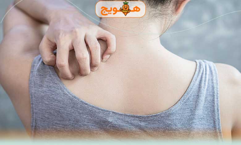 روشهای پیشگیری از اثرات منفی کبد چرب روی پوست؟