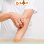 خارش بدن ناشی از کبد چرب چیست و چگونه می توان درمان کرد؟ 
