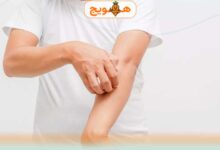 خارش بدن ناشی از کبد چرب چیست و چگونه می توان درمان کرد؟ 