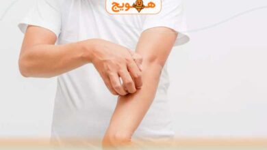 خارش بدن ناشی از کبد چرب چیست و چگونه می توان درمان کرد؟ 