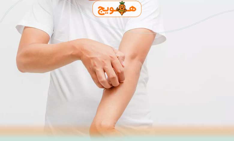 خارش بدن ناشی از کبد چرب چیست و چگونه می توان درمان کرد؟