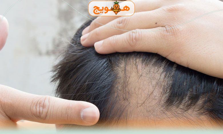 کبد چرب چیست و چرا ایجاد می‌شود؟