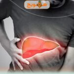 عوارض کبد چرب