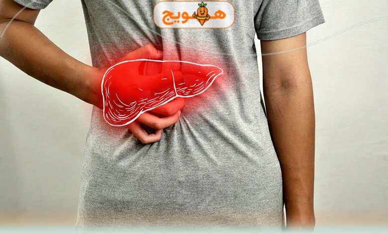 نشانه های ابتلا به کبد چرب